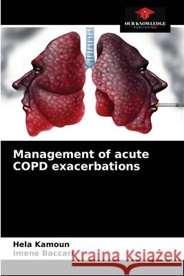 Management of acute COPD exacerbations Hela Kamoun, Imene Baccari 9786204074375 Our Knowledge Publishing