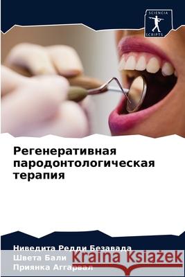 Регенеративная пародон&# Безавk 9786204078809 Sciencia Scripts