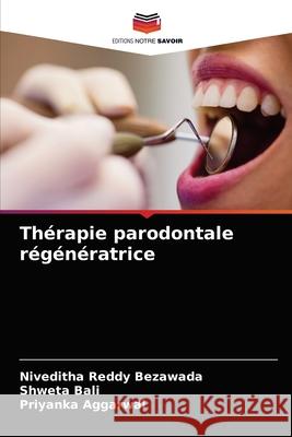 Thérapie parodontale régénératrice Bezawada, Niveditha Reddy 9786204078830 Editions Notre Savoir