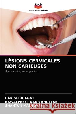 Lésions Cervicales Non Carieuses Garish Bhagat, Kawalpreet Kaur Bhullar, Shantun Malhotra 9786204079783