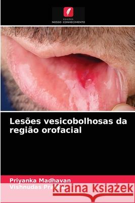 Lesões vesicobolhosas da região orofacial Priyanka Madhavan, Vishnudas Prabhu 9786204086989