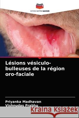 Lésions vésiculo-bulleuses de la région oro-faciale Madhavan, Priyanka 9786204087016