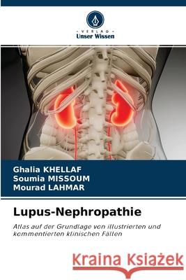 Lupus-Nephropathie Ghalia Khellaf, Soumia Missoum, Mourad Lahmar 9786204100494 Verlag Unser Wissen