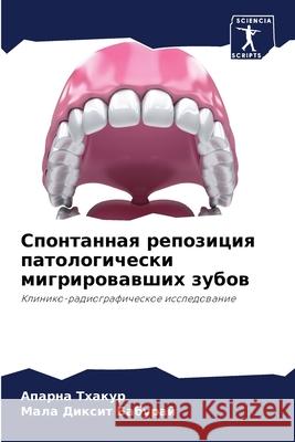 Спонтанная репозиция па& Тхакуl 9786204106298 Sciencia Scripts