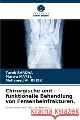 Chirurgische und funktionelle Behandlung von Fersenbeinfrakturen. Tarek Bardaa, Marwa Mayel, Mohamed Ali Rekik 9786204114385