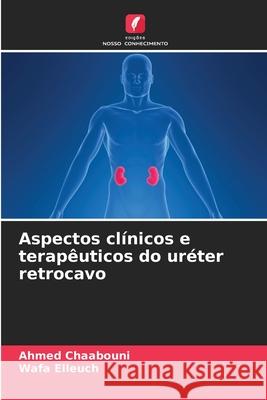 Aspectos clínicos e terapêuticos do uréter retrocavo Ahmed Chaabouni, Wafa Elleuch 9786204123646