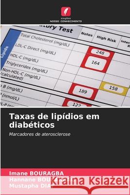 Taxas de lipídios em diabéticos Imane Bouragba, Hannane Boularbag, Mustapha Diaf 9786204127767