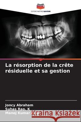 La résorption de la crête résiduelle et sa gestion Abraham, Joncy 9786204130392