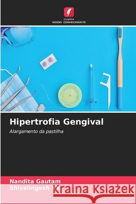 Hipertrofia Gengival Nandita Gautam, Shivalingesh Kk 9786204135342 Edicoes Nosso Conhecimento