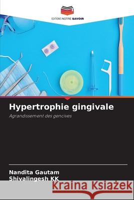 Hypertrophie gingivale Nandita Gautam Shivalingesh Kk 9786204135373