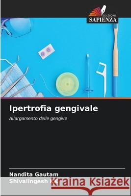 Ipertrofia gengivale Nandita Gautam Shivalingesh Kk 9786204135380 Edizioni Sapienza