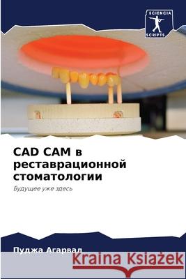 CAD CAM в реставрационной стоматологи& Пуджа Агарвал 9786204143309 Sciencia Scripts