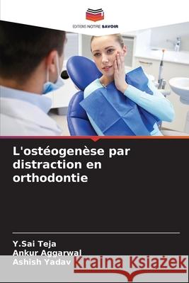 L'ostéogenèse par distraction en orthodontie Y Sai Teja, Ankur Aggarwal, Ashish Yadav 9786204148021 Editions Notre Savoir