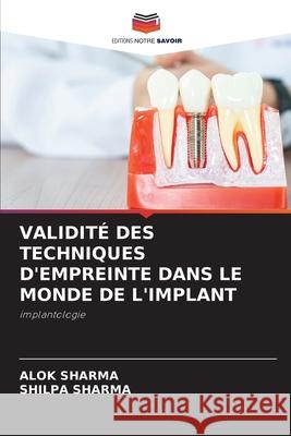 Validité Des Techniques d'Empreinte Dans Le Monde de l'Implant Alok Sharma, Shilpa Sharma 9786204148731 Editions Notre Savoir