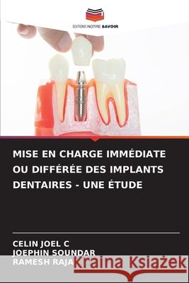 Mise En Charge Immédiate Ou Différée Des Implants Dentaires - Une Étude Celin Joel C, Joephin Soundar, Ramesh Raja 9786204150116 Editions Notre Savoir