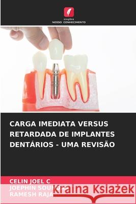 Carga Imediata Versus Retardada de Implantes Dentários - Uma Revisão Celin Joel C, Joephin Soundar, Ramesh Raja 9786204150130