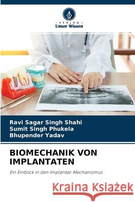 Biomechanik Von Implantaten Ravi Sagar Singh Shahi, Sumit Singh Phukela, Bhupender Yadav 9786204152707