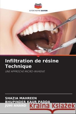 Infiltration de résine Technique Shazia Mahreen, Bhupinder Kaur Padda, Juhi Anand 9786204153810