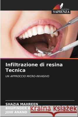 Infiltrazione di resina Tecnica Shazia Mahreen, Bhupinder Kaur Padda, Juhi Anand 9786204153827