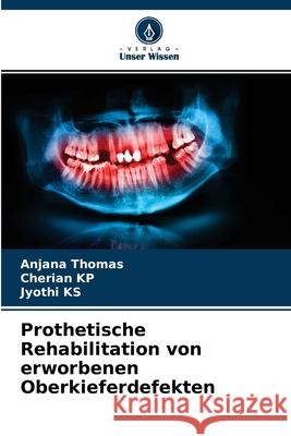 Prothetische Rehabilitation von erworbenen Oberkieferdefekten Anjana Thomas, Cherian Kp, Jyothi Ks 9786204154855