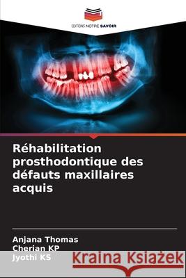 Réhabilitation prosthodontique des défauts maxillaires acquis Anjana Thomas, Cherian Kp, Jyothi Ks 9786204154879