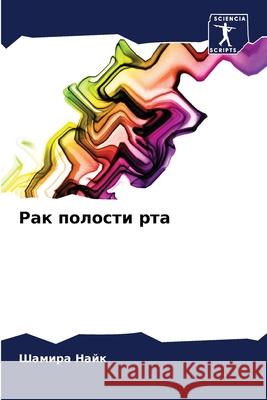 Рак полости рта Найк, Ш 9786204157887 Sciencia Scripts