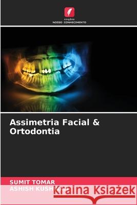 Assimetria Facial & Ortodontia Sumit Tomar, Ashish Kushwah 9786204158471