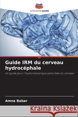 Guide IRM du cerveau hydrocéphale Amna Babar 9786204159416 Editions Notre Savoir