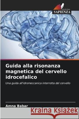 Guida alla risonanza magnetica del cervello idrocefalico Amna Babar 9786204159423 Edizioni Sapienza