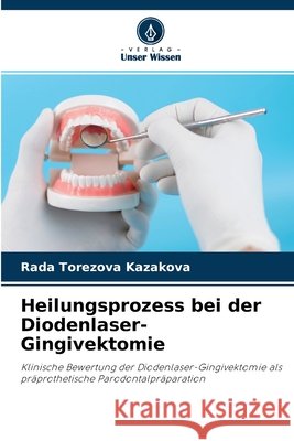 Heilungsprozess bei der Diodenlaser-Gingivektomie Rada Torezova Kazakova 9786204163987