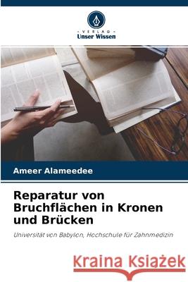 Reparatur von Bruchflächen in Kronen und Brücken Ameer Alameedee 9786204168029