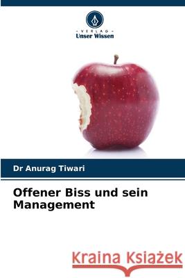 Offener Biss und sein Management Dr Anurag Tiwari 9786204173658