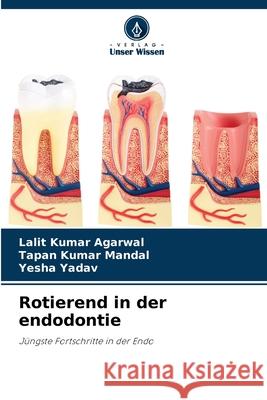 Rotierend in der endodontie Lalit Kumar Agarwal, Tapan Kumar Mandal, Yesha Yadav 9786204174334