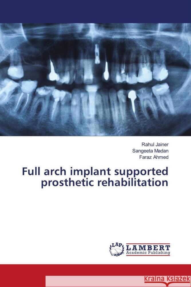 Full arch implant supported prosthetic rehabilitation Jainer, Rahul, Madan, Sangeeta, Ahmed, Faraz 9786204181486