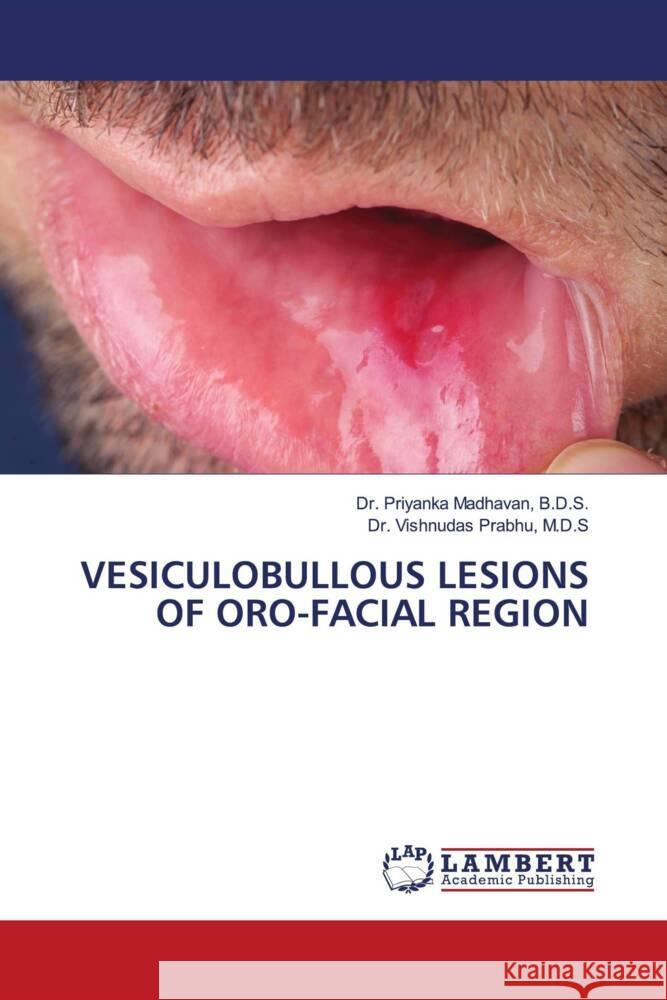 VESICULOBULLOUS LESIONS OF ORO-FACIAL REGION Madhavan, B.D.S., Dr. Priyanka, Prabhu, M.D.S, Dr. Vishnudas 9786204183145 LAP Lambert Academic Publishing