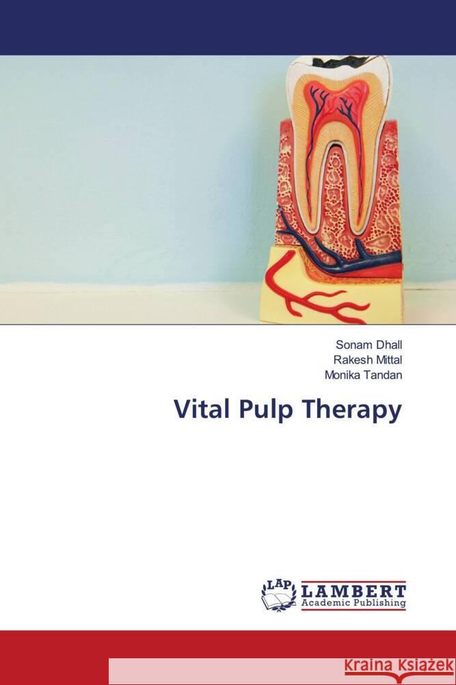 Vital Pulp Therapy Dhall, Sonam, Mittal, Rakesh, Tandan, Monika 9786204184241