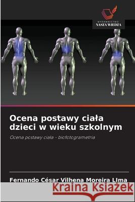 Ocena postawy ciala dzieci w wieku szkolnym Moreira LIma, Fernando César Vilhena 9786204185590