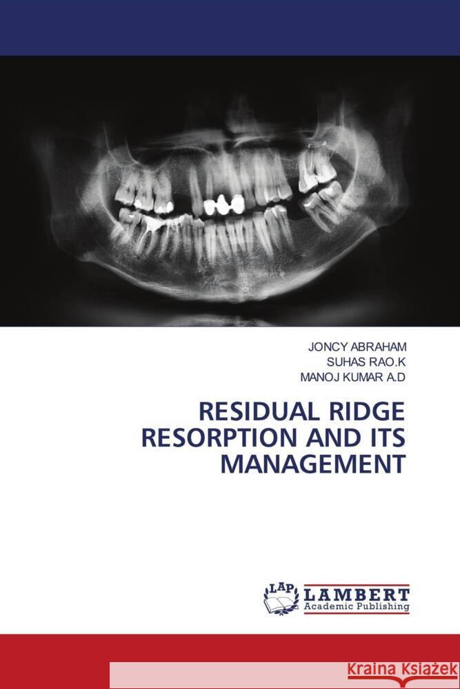 RESIDUAL RIDGE RESORPTION AND ITS MANAGEMENT ABRAHAM, JONCY, RAO.K, SUHAS, KUMAR A.D, MANOJ 9786204190303