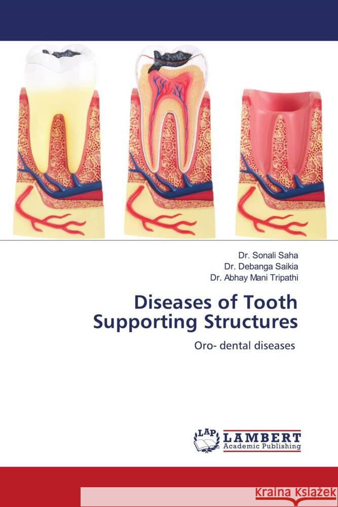 Diseases of Tooth Supporting Structures Saha, Dr. Sonali, Saikia, Dr. Debanga, Tripathi, Dr. Abhay Mani 9786204202570