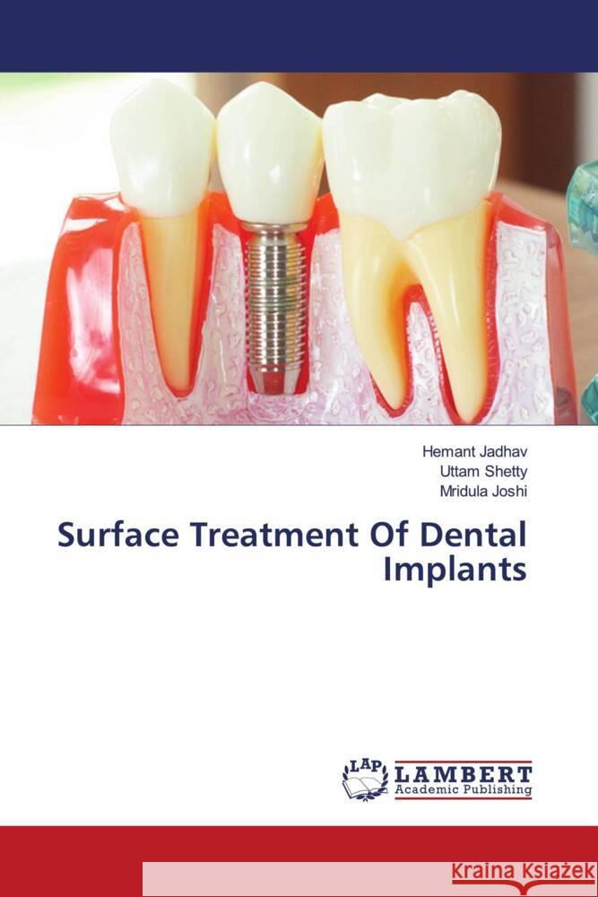 Surface Treatment Of Dental Implants Jadhav, Hemant, Shetty, Uttam, Joshi, Mridula 9786204206486