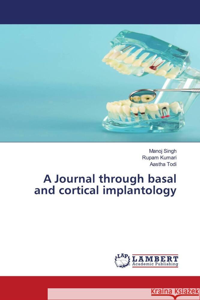 A Journal through basal and cortical implantology Singh, Manoj, Kumari, Rupam, Todi, Aastha 9786204208008