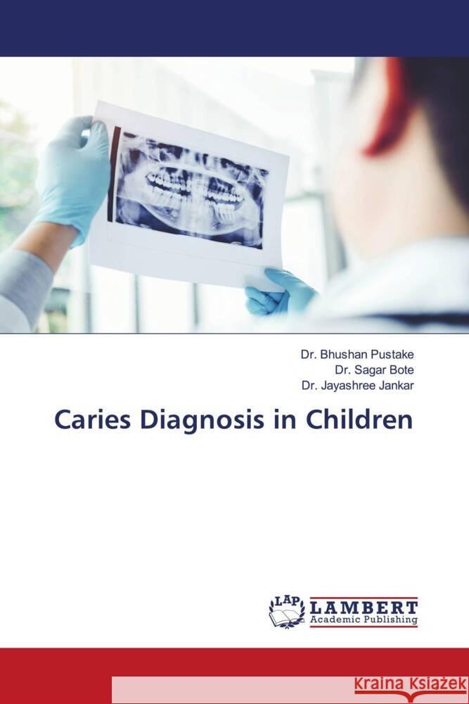 Caries Diagnosis in Children Pustake, Dr. Bhushan, Bote, Dr. Sagar, Jankar, Dr. Jayashree 9786204209074