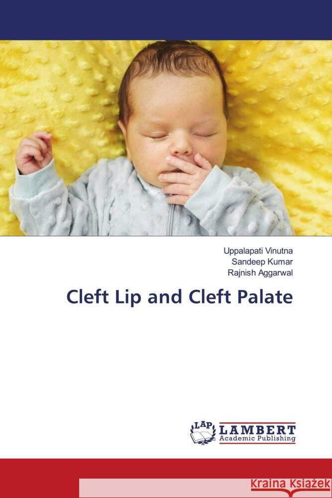 Cleft Lip and Cleft Palate Vinutna, Uppalapati, Kumar, Sandeep, AGGARWAL, RAJNISH 9786204210568 LAP Lambert Academic Publishing