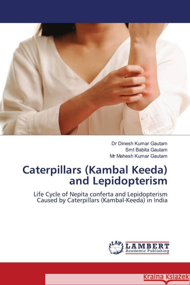 Caterpillars (Kambal Keeda) and Lepidopterism Gautam, Dr Dinesh Kumar, Gautam, Smt Babita, Gautam, Mr Mahesh Kumar 9786204212234