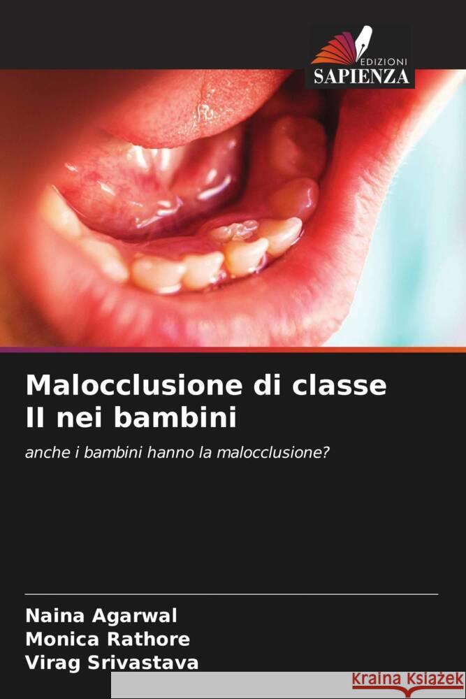 Malocclusione di classe II nei bambini Agarwal, Naina, Rathore, Monica, Srivastava, Virag 9786204221342