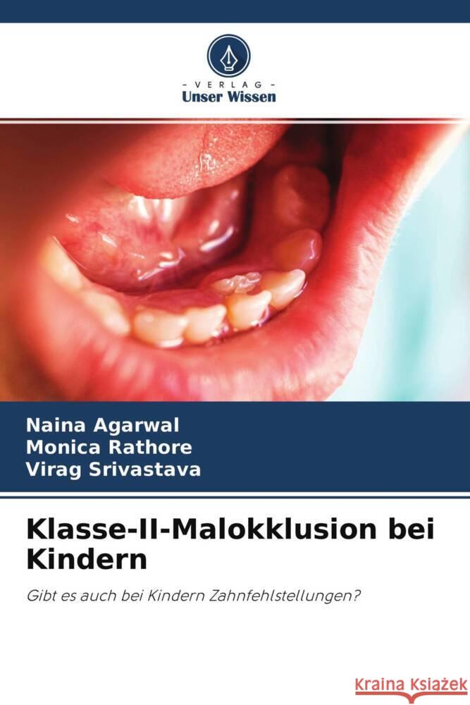 Klasse-II-Malokklusion bei Kindern Agarwal, Naina, Rathore, Monica, Srivastava, Virag 9786204221366