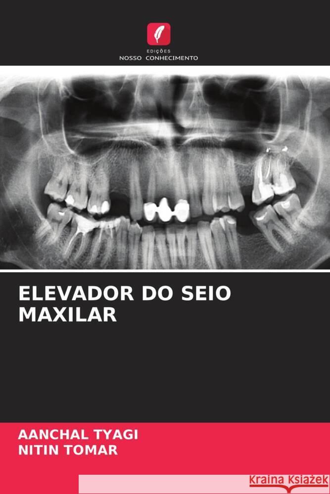 ELEVADOR DO SEIO MAXILAR Tyagi, Aanchal, Tomar, Nitin 9786204226347