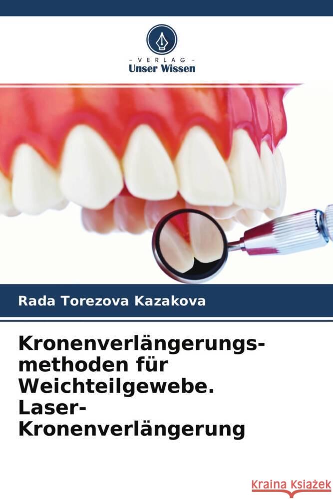 Kronenverlängerungs- methoden für Weichteilgewebe. Laser-Kronenverlängerung Kazakova, Rada Torezova 9786204226880