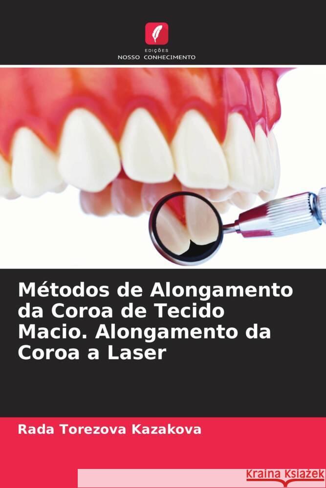 Métodos de Alongamento da Coroa de Tecido Macio. Alongamento da Coroa a Laser Kazakova, Rada Torezova 9786204226927