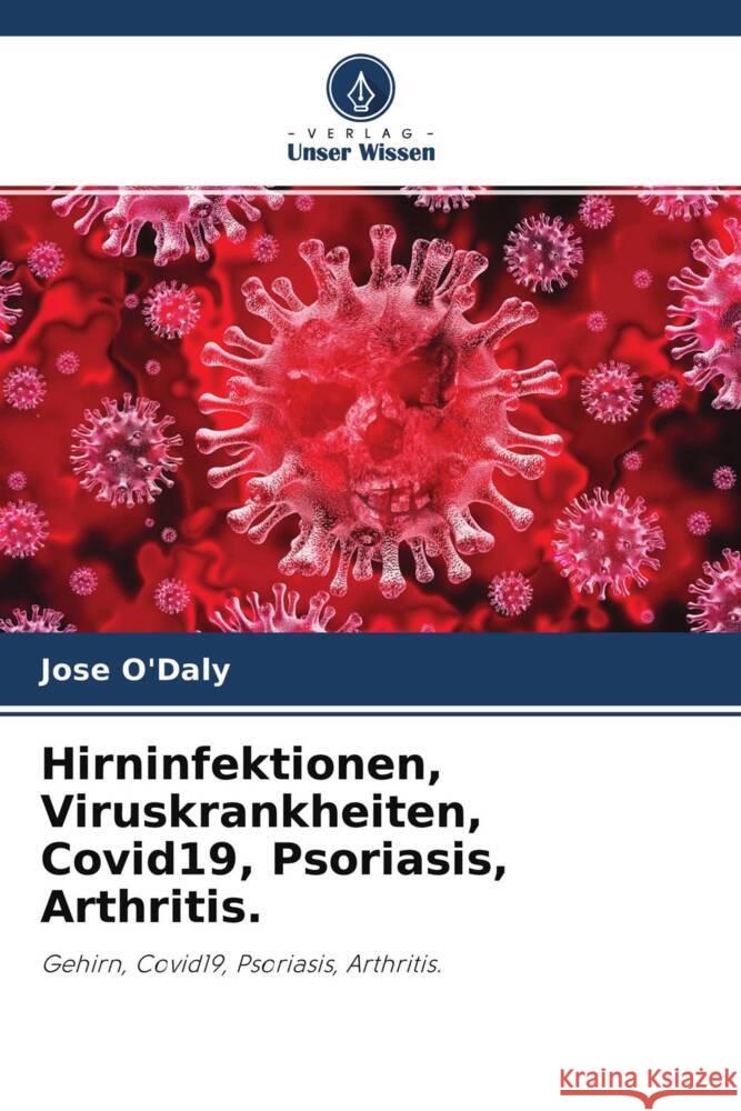 Hirninfektionen, Viruskrankheiten, Covid19, Psoriasis, Arthritis. O'Daly, Jose 9786204240497 Verlag Unser Wissen